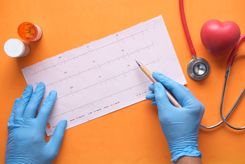 Stéthoscope et tracé cardiaque symbolisant le diagnostic de l'engagement des salariés en entreprise.